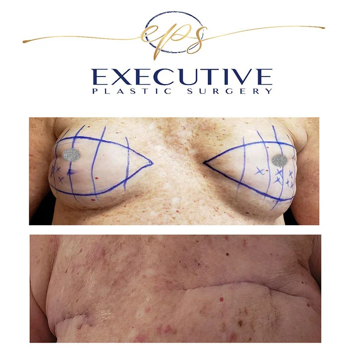 Executive Plastic Surgery logo with decorative gold line